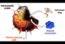 New Drug Carrier Aims to Treat Secondary Tumours of Breast Cancer