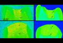 Neutrons and X-rays show how to prepare durable tooth cement