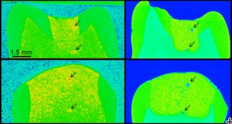 Neutron and X-Ray images