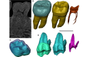 Deep look into teeth with neutrons