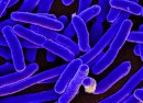 Neutrons help to analyse outer surface interactions on E. coli 